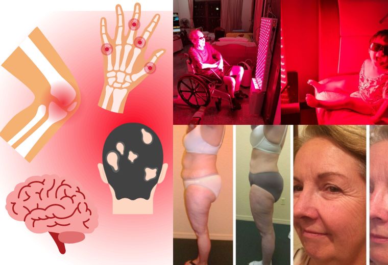 Red Light Therapy (Photobiomodulation): A Summary of Mark Sloan's Book